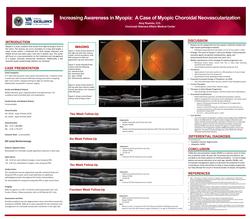 Increasing Awareness in Myopia- A Case of Myopic Choroidal Neovascularization